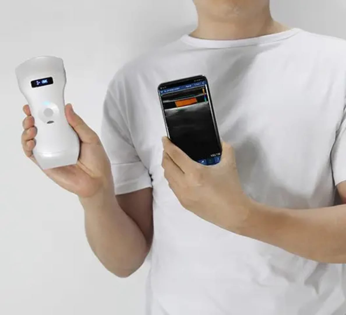 Portable High Resolution Fully Digital Wireless 256-Element 3-in-1 Color Doppler Ultrasound Scanner for Human Clinical Diagnosis (Delivery in 12 Days)