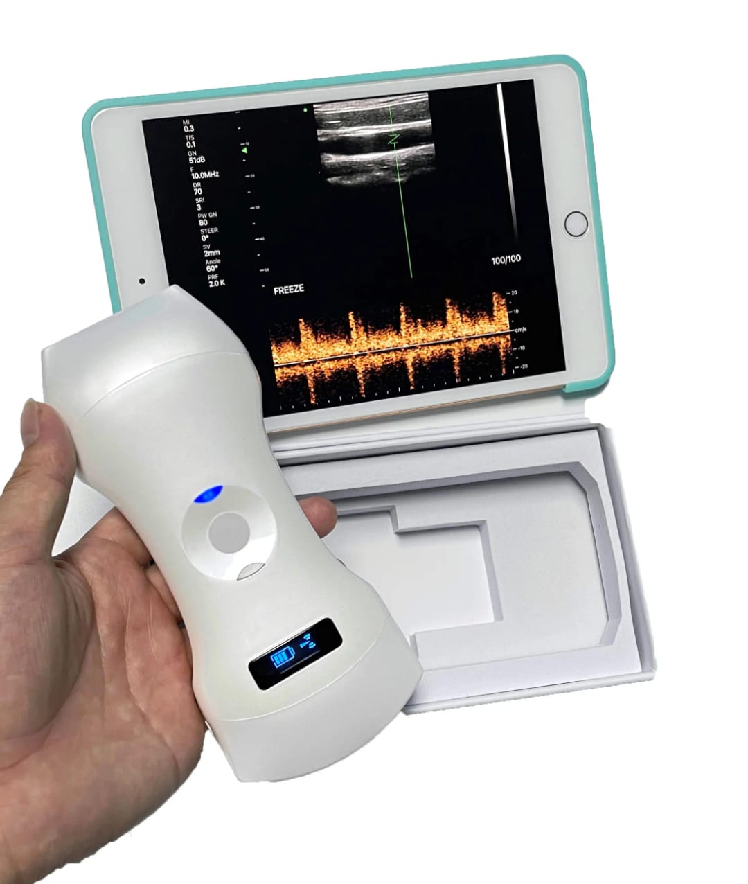 Portable High Resolution Fully Digital Wireless 256-Element 3-in-1 Color Doppler Ultrasound Scanner for Human Clinical Diagnosis (Delivery in 12 Days)