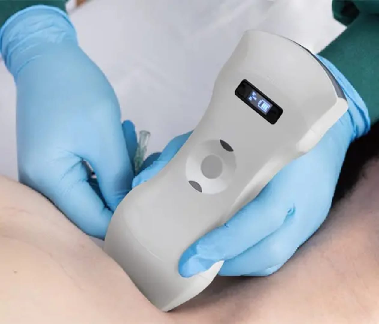 Portable High Resolution Fully Digital Wireless 256-Element 3-in-1 Color Doppler Ultrasound Scanner for Human Clinical Diagnosis (Delivery in 12 Days)