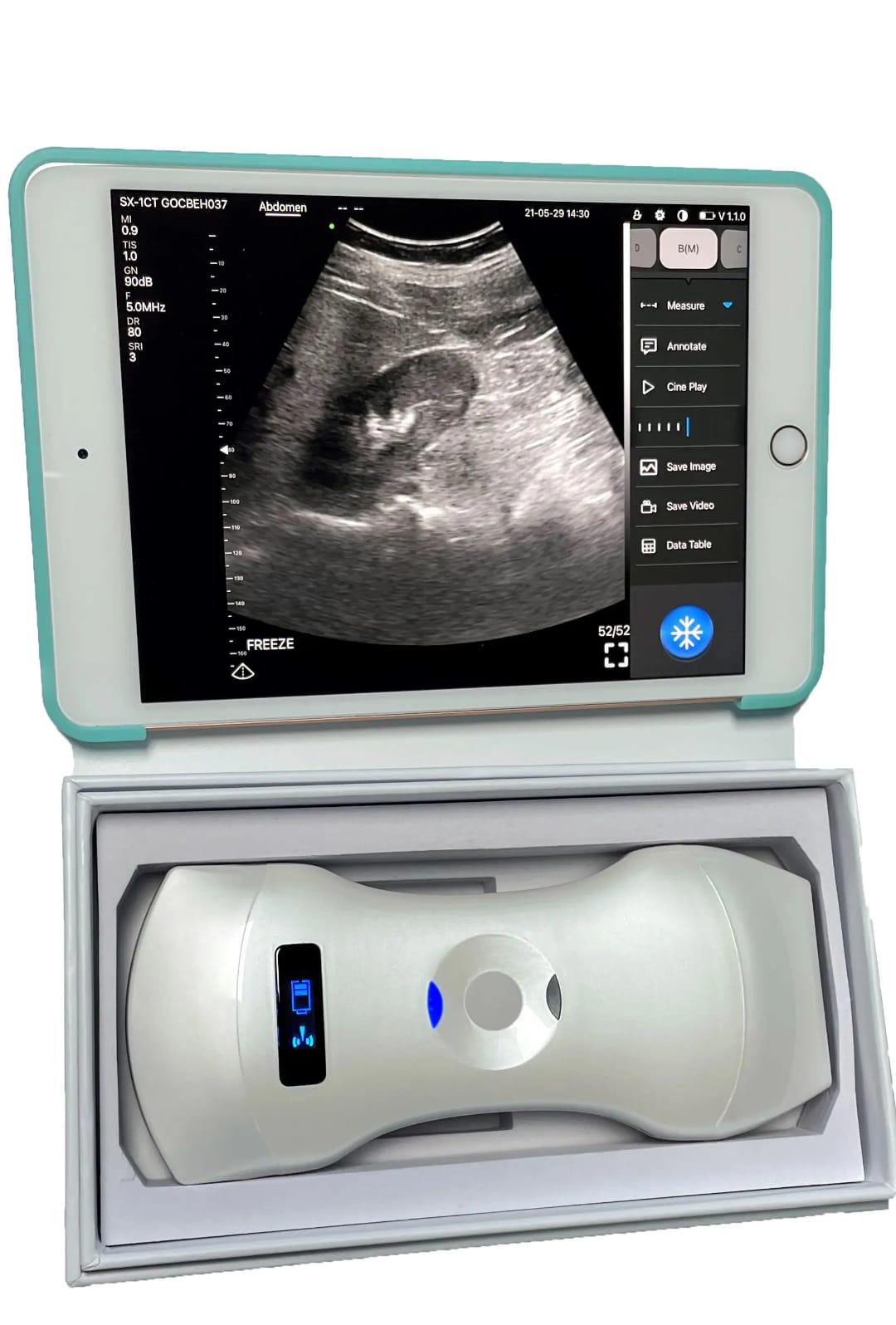 Portable High Resolution Fully Digital Wireless 256-Element 3-in-1 Color Doppler Ultrasound Scanner for Human Clinical Diagnosis (Delivery in 12 Days)