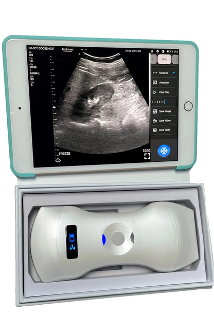 Portable High Resolution Fully Digital Wireless 256-Element 3-in-1 Color Doppler Ultrasound Scanner for Human Clinical Diagnosis (Delivery in 12 Days)