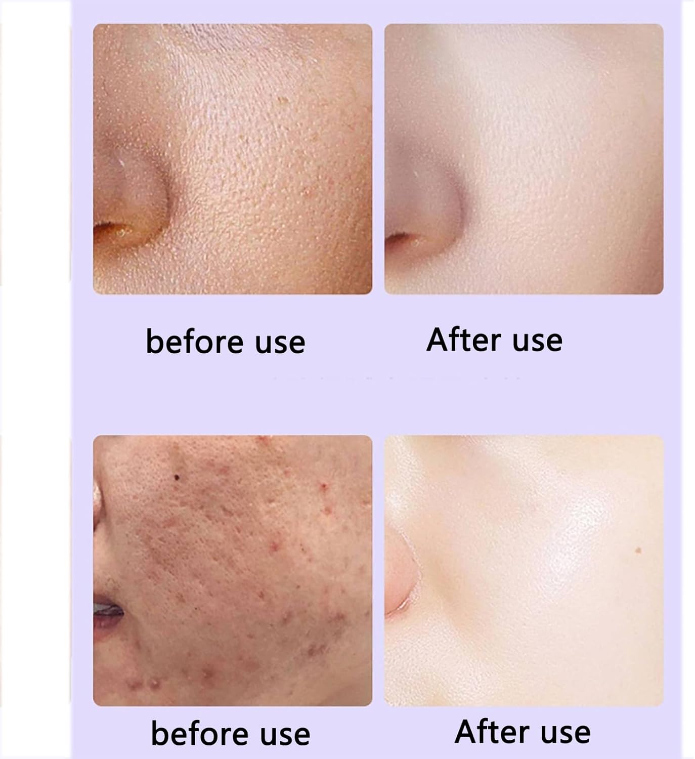 CALMORA Skin Tightening Machine, Photon Skin Rejuvenation Whitening Machine with IPL+LED Technology and 630nm Wavelength, 4 Major Advantages and 0 Medium, 28 Days Visible Results