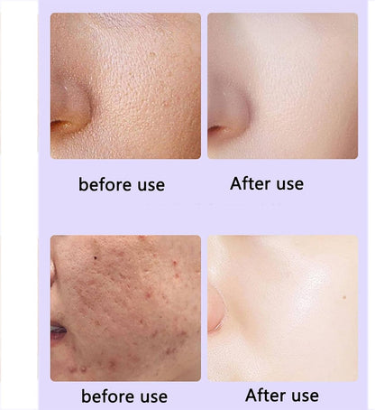 CALMORA Skin Tightening Machine, Photon Skin Rejuvenation Whitening Machine with IPL+LED Technology and 630nm Wavelength, 4 Major Advantages and 0 Medium, 28 Days Visible Results