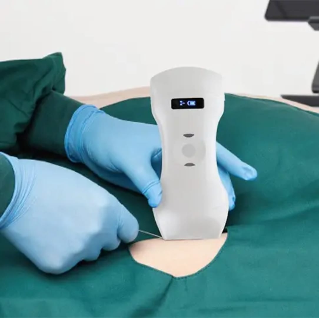 Portable High Resolution Fully Digital Wireless 256-Element 3-in-1 Color Doppler Ultrasound Scanner for Human Clinical Diagnosis (Delivery in 12 Days)