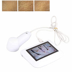 CALMORA Skin Hair Analyser,5 in 50X/200xLens LCD Digital Microscope Rechargeable Portable Scalp Detector Scanner Professional Scalp Hair Follicle Oil Magnifying Detector Skin Pigm